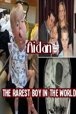 Watch Aidan The Rarest Boy In The World 9Movies
