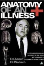 Watch Anatomy of an Illness 9Movies