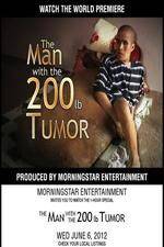 Watch The Man With The 200lb Tumor 9Movies