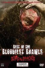 Watch TNA Wrestling: Best of the Bloodiest Brawls - Scars and Stitches 9Movies