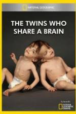 Watch National Geographic The Twins Who Share A Brain 9Movies