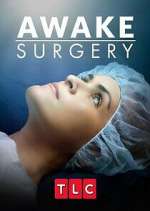 Watch Awake Surgery 9Movies